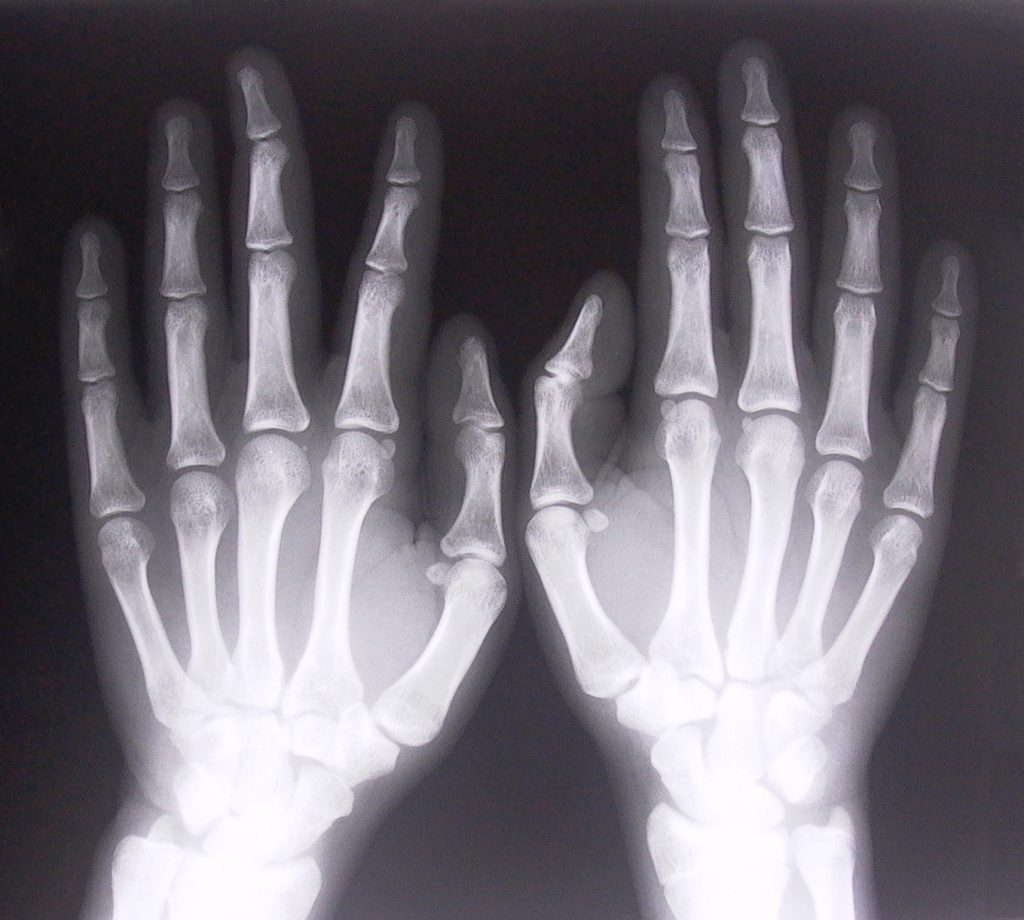 xray-of-hands-1526780-1024x920