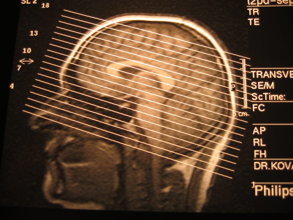 x-ray-head-1435093
